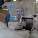 Broncopneumonia: entenda quadro que causou internação de Bolsonaro