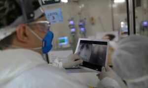 Broncopneumonia: entenda quadro que causou internação de Bolsonaro