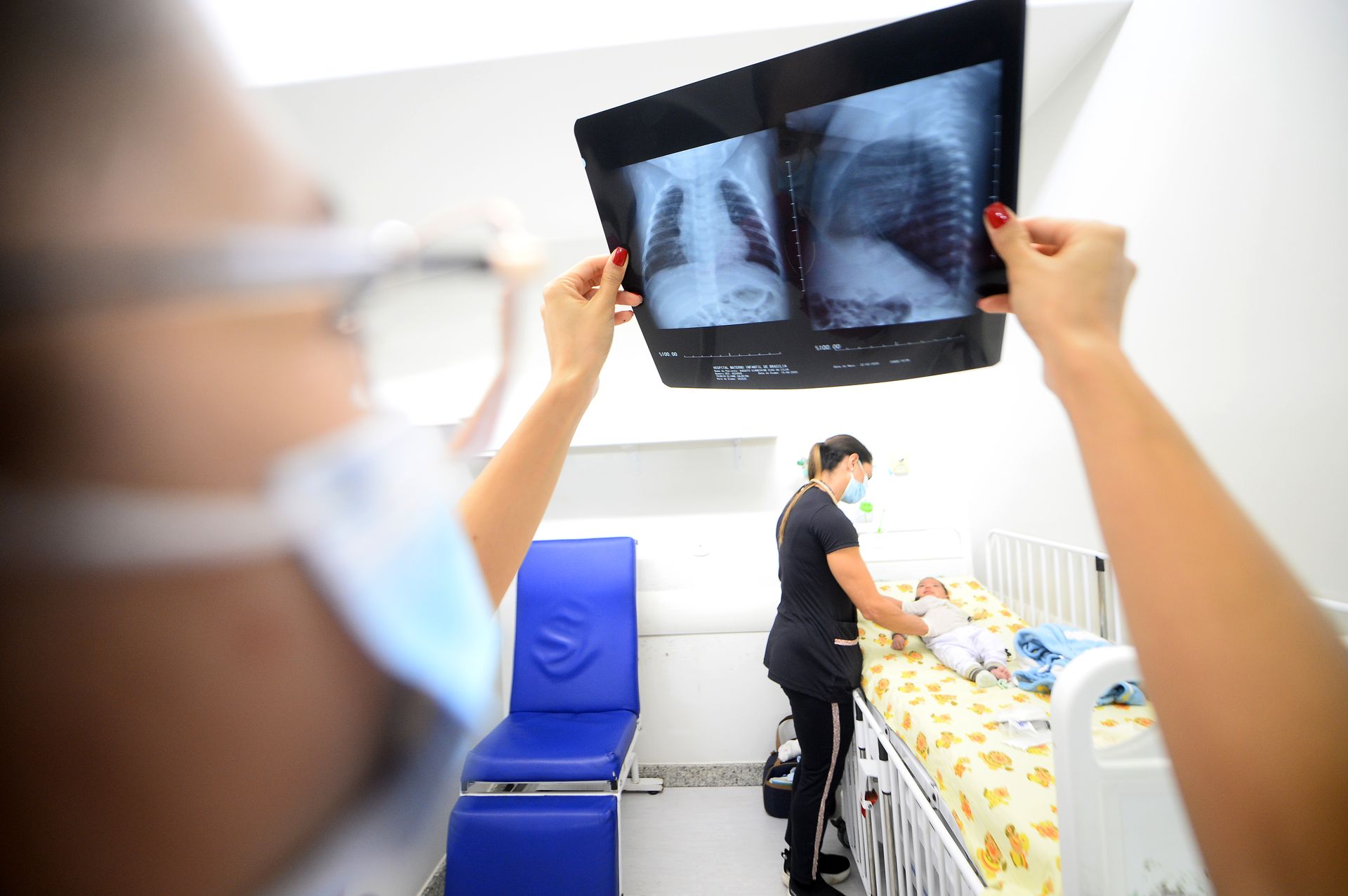 Aumento de casos de síndrome gripal exige atenção redobrada com crianças e idosos