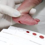 DF é pioneiro no diagnóstico precoce da doença de Fabry pelo teste do pezinho