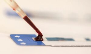 Estudo inédito da Fiocruz pode ampliar prevenção de HIV entre jovens