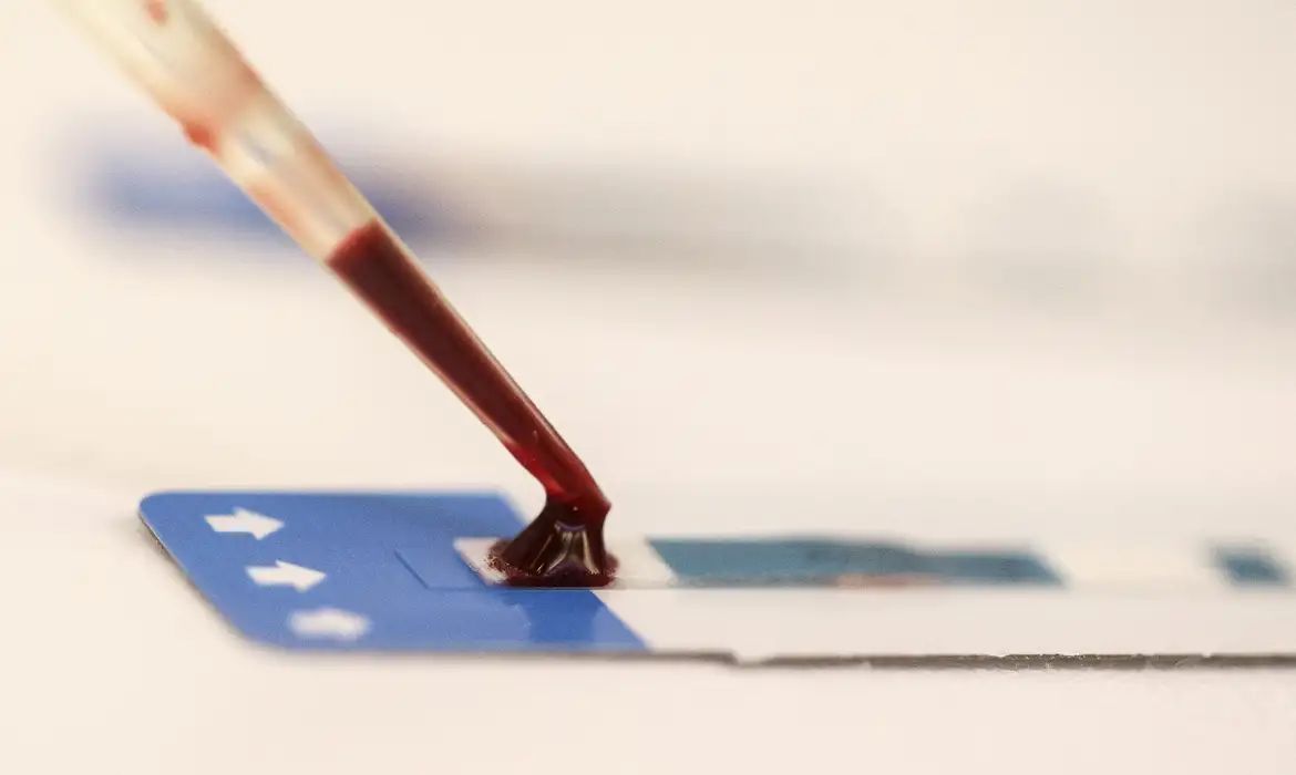 Estudo inédito da Fiocruz pode ampliar prevenção de HIV entre jovens