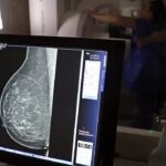 Nova lei reforça direito a três folgas por ano para exames preventivos