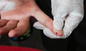 Brasil atinge meta de redução da transmissão vertical de hepatite B