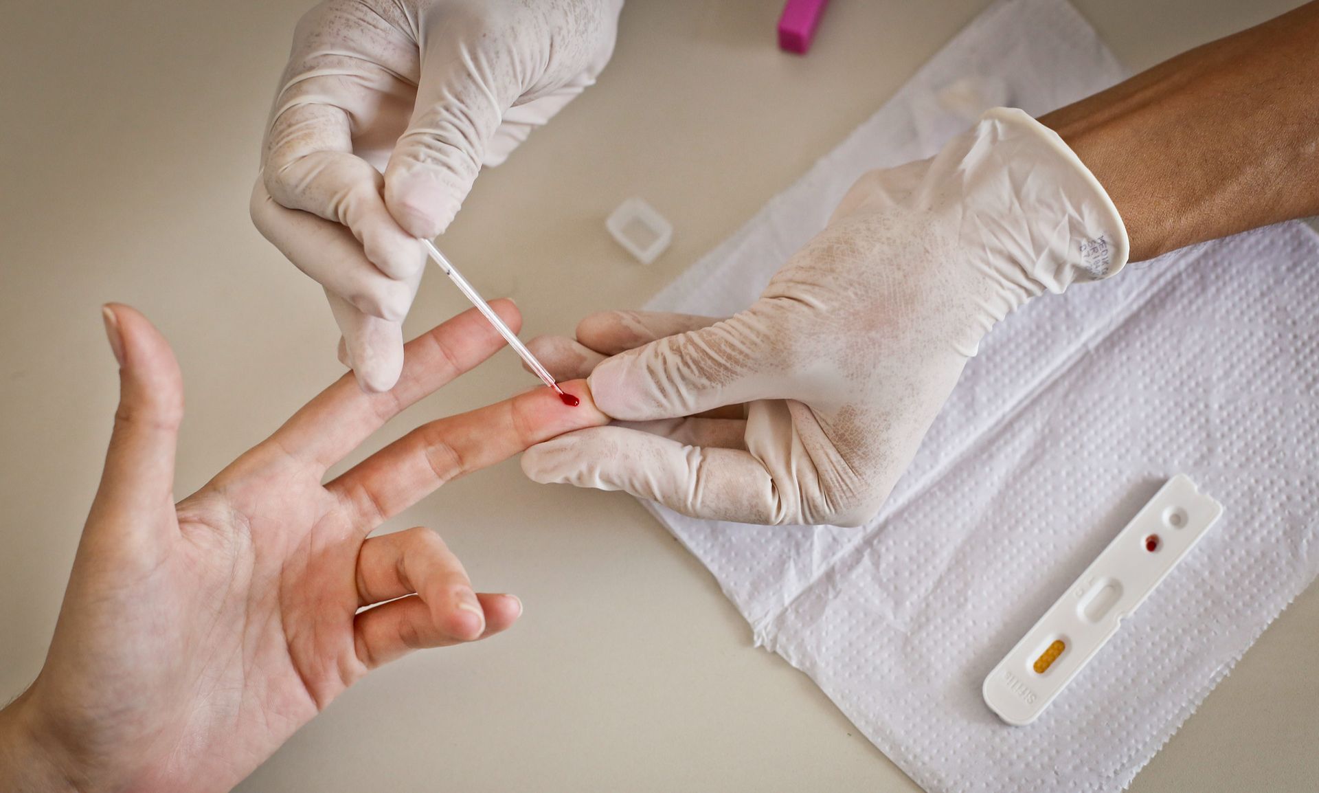 Preconceito contra pacientes com HIV ainda afasta pessoas de diagnóstico e cuidado