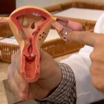 Aberta chamada pública para pesquisas sobre endometriose