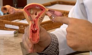 Aberta chamada pública para pesquisas sobre endometriose