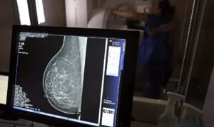Médicos lançam guia para evitar recusa de mamografia digital